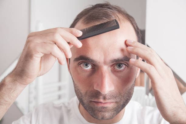 Hair Transplant Turkey Cost: What Makes It So Affordable